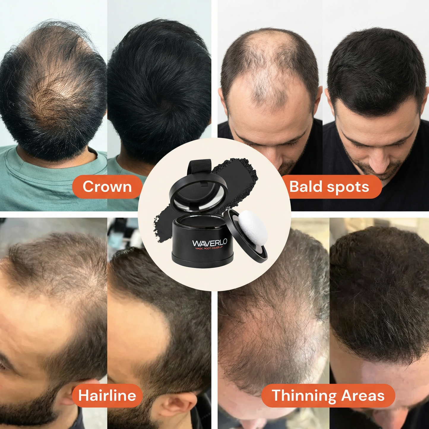 Hair Density Filler