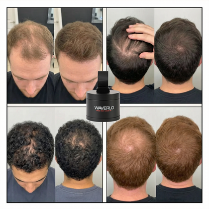 Hair Density Filler